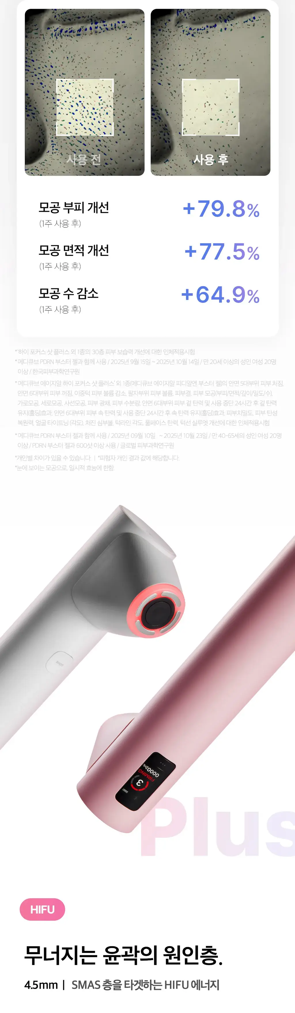 [고강도초음파] 메디큐브 에이지알 하이포커스샷 플러스 (핑크/베이지) 상세페이지 20